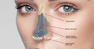 Rhinoplasty Turkey