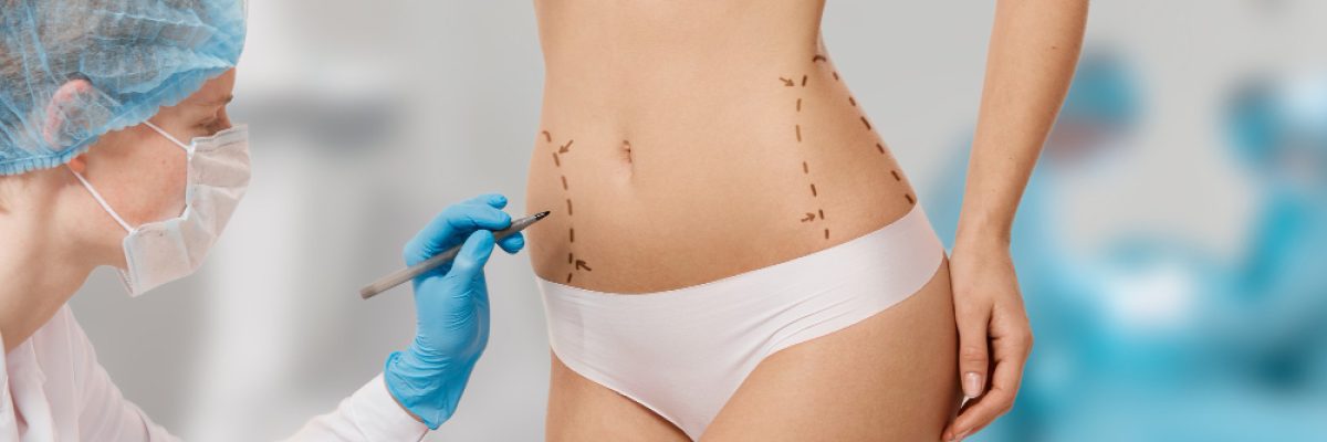 woman-marked-out-cosmetic-surgery-2